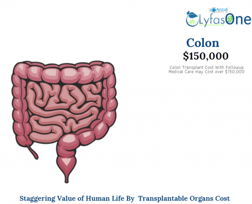Organ Transplant cost of Colons.